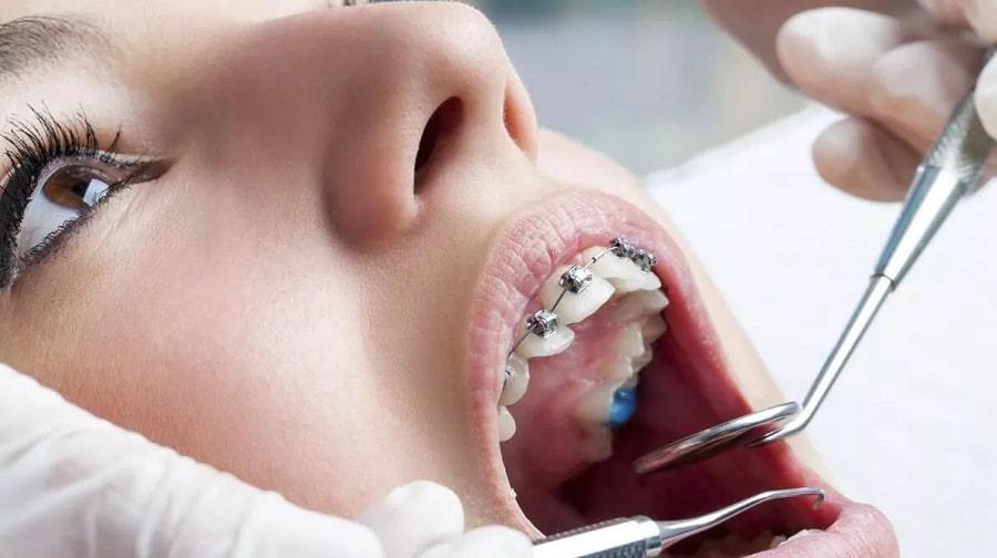 orthodontist check